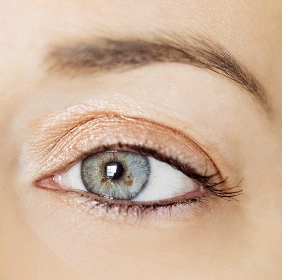 woman's eye and skin around the eye that had botox